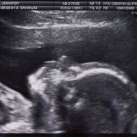 SaraRose/2007/01/ultrasounds/Images/